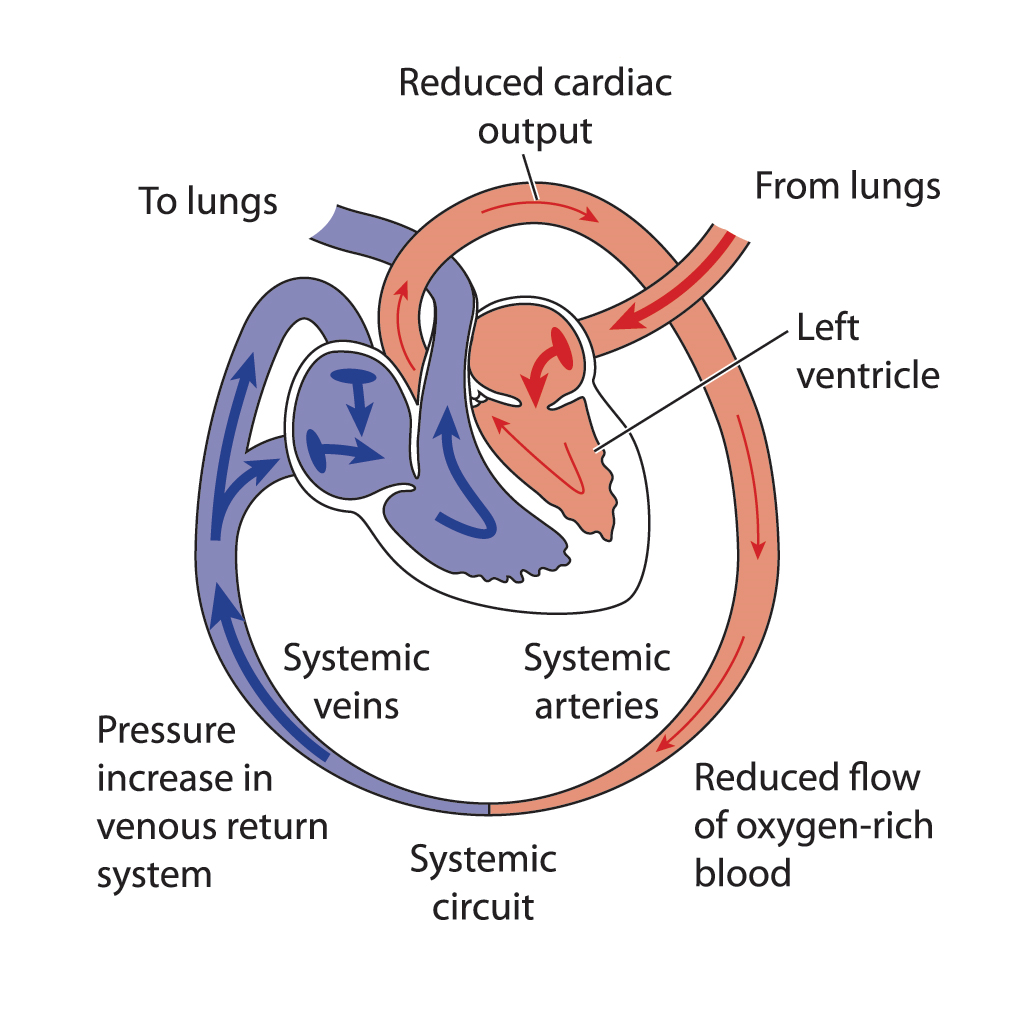 Heart Failure Dr Debargha Dhua Mbbs Md Dm Cardiology